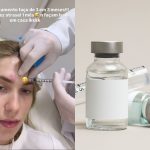 Botox no controle da enxaqueca: especialista esclarece dúvidas sobre tratamento de Virginia