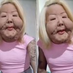 Após cirurgia reconstrutiva, Juju do Pix revela novo rosto e agradece apoio