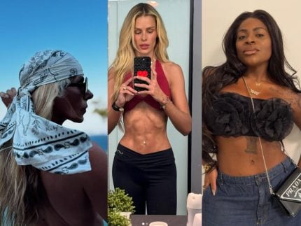 Sem filtro: conheça as famosas que enfrentaram a pressão estética e se posicionaram