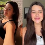 Grávida, Franciny Ehlke é criticada por preenchimentos e rebate: “Chama gravidez”