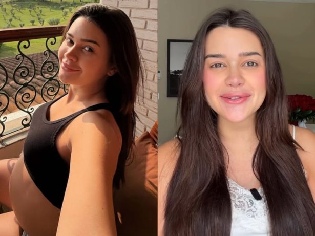 Grávida, Franciny Ehlke é criticada por preenchimentos e rebate: “Chama gravidez”