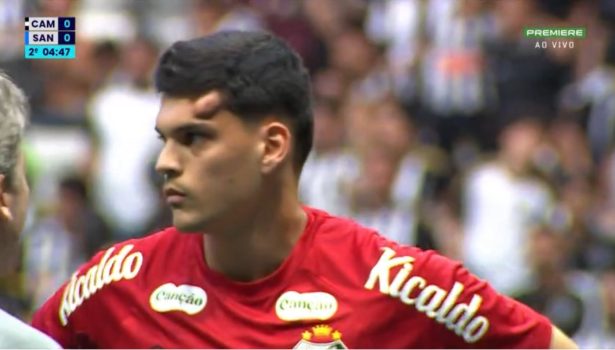 Goleiro do Santos fica com galo na cabeça e sai de ambulância de campo