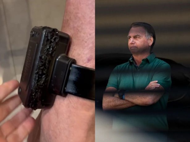 Veja o estado da tornozeleira eletrônica de Bolsonaro após tentativa de violação
