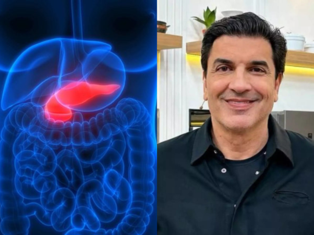 Câncer de pâncreas: Médico explica diagnóstico de Edu Guedes e desafios do tratamento