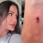 Gracyanne Barbosa sofre acidente durante treino na academia e mostra o corte