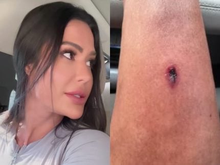 Gracyanne Barbosa sofre acidente durante treino na academia e mostra o corte