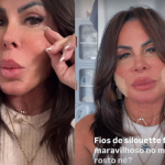 Gretchen aparece sem curativos e rebate haters que a chamaram de “fofão”