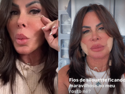 Gretchen aparece sem curativos e rebate haters que a chamaram de “fofão”