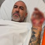 Henrique Fogaça expõe feridas de acidente e revela roubo de aliança em hospital