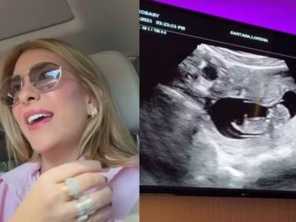 Lore Improta vibra ao compartilhar ultrassom da 2ª gestação: “Tá dançando”