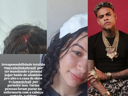 Mulher leva 3 pontos na cabeça após ser atingida por balde em show de MC Cabelinho