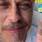 Após picada de jararaca, ator Guilherme Fontes mostra evolução do ferimento