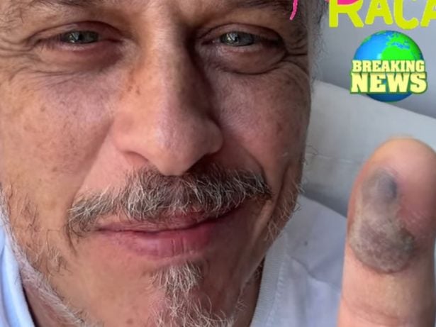 Após picada de jararaca, ator Guilherme Fontes mostra evolução do ferimento