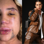 Influenciador de moda morre por complicações após procedimento estético