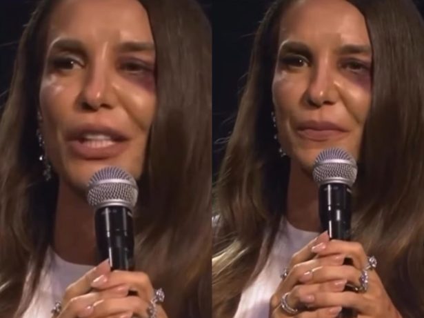 Ivete Sangalo confirma que passará por cirurgia neste domingo