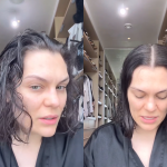 Jessie J revela queda de cabelo após mastectomia e fala sobre recuperação do câncer