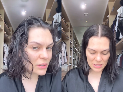 Jessie J revela queda de cabelo após mastectomia e fala sobre recuperação do câncer