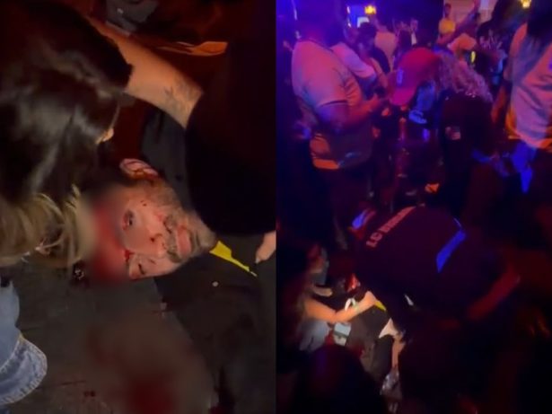 Organização de evento no RJ nega superlotação após jovem ser agredido até desmaiar