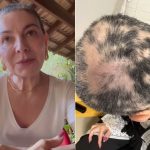 Após melhora, mãe de Lucas Lucco lamenta recaída de alopecia severa: “Mais triste”
