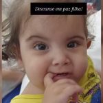 Bebê siamesa morre após cirurgia de separação; irmã segue em estado grave