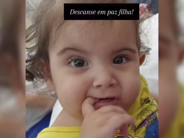 Bebê siamesa morre após cirurgia de separação; irmã segue em estado grave