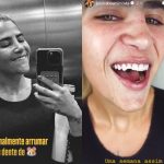 Filha de Leonardo, Jéssica Beatriz mostra dente quebrado após queda: “Dentes de rato”