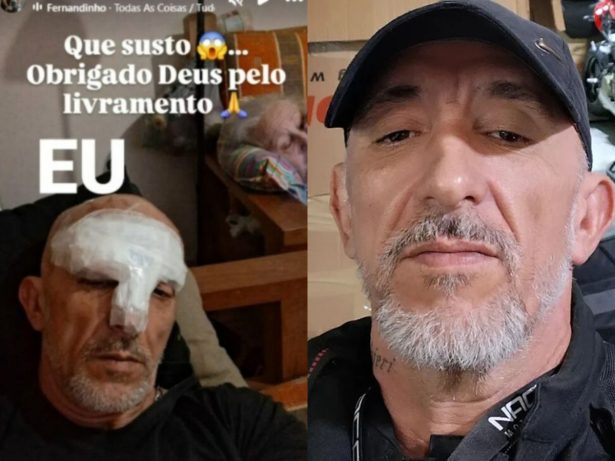 Cristian Cravinhos aparece ferido após acidente e agradece pelo livramento: “Obrigado, Deus!”