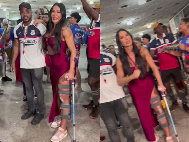 De muletas, Gracyanne Barbosa surpreende ao surgir em ensaio da União da Ilha