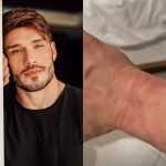 Campeão de “A Fazenda”, Lucas Viana aparece ferido e diz ter sido detido em Dubai