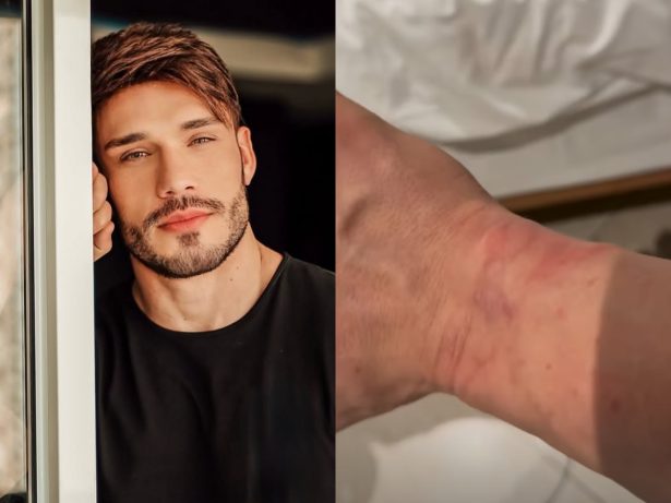Campeão de “A Fazenda”, Lucas Viana aparece ferido e diz ter sido detido em Dubai