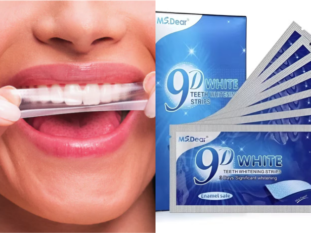 Anvisa proíbe comercialização e importação de fitas para clareamento dental