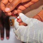 Três países africanos lançam aplicação inédita de injeção semestral contra o HIV
