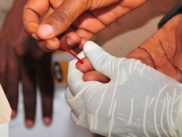 Três países africanos lançam aplicação inédita de injeção semestral contra o HIV
