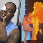 Rapper Major RD leva susto com máquina de fogo e se queima em show