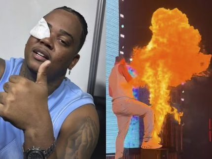 Rapper Major RD leva susto com máquina de fogo e se queima em show