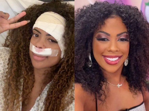Marvvila passa por cirurgias após descobrir tumor no ouvido: “Em processo de recuperação”