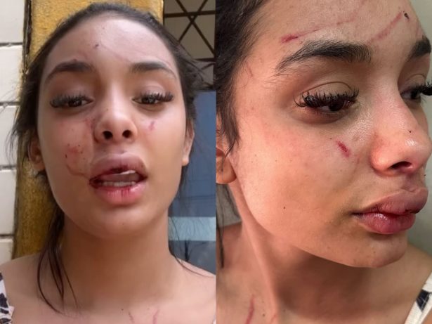 Mulher agredida por Bia Miranda anuncia medidas judiciais contra ataques na internet