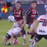 Ayrton Lucas sofre ferimento grave e fica com osso à mostra em jogo do Flamengo