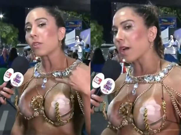 Mulher Melão revela que cortou pedaço de bolsa para cobrir partes íntimas para o Carnaval