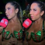 Mulher Melão revela que se machucou com cola no tapa-sexo em desfile: “Doeu muito”