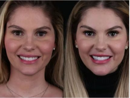 Bárbara Evans mexe no rosto após remover excesso de gordura do corpo. Veja o resultado!