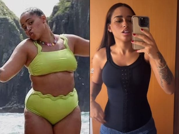 MC Loma mostra cinturinha fina, resultado da lipo. Veja o antes e depois!