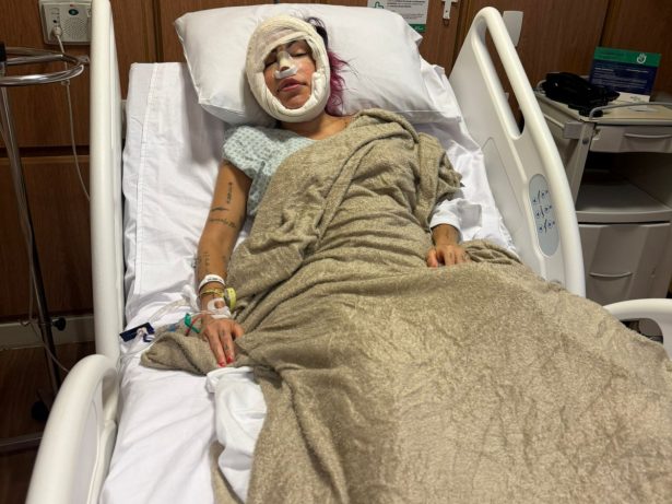 De cara nova! Liziane exibe resultado da cirurgia antecipada pelo portal LeoDias; confira