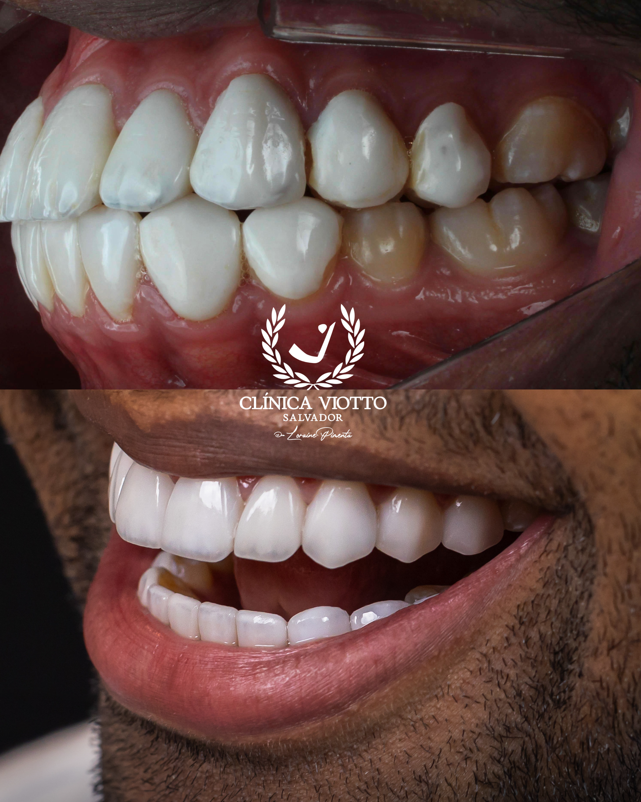 Foto: Divulgação / Dr. Viotto