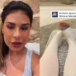 Simone Mendes passa por cirurgia nas coxas e admite: “Me deixava com autoestima baixa”