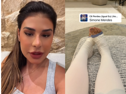 Simone Mendes passa por cirurgia nas coxas e revela drama com autoestima