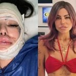 Sem medo do bisturi, Liziane Gutierrez vai encarar nova cirurgia após mais de 20 plásticas
