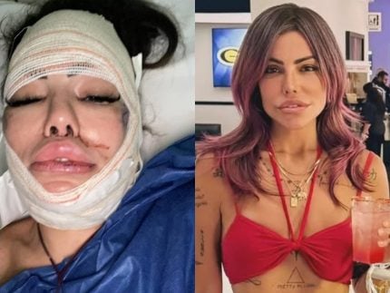 Sem medo do bisturi, Liziane Gutierrez vai encarar nova cirurgia após mais de 20 plásticas