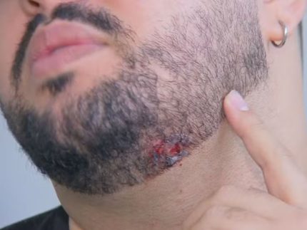 Homem atingido de raspão em tiroteio no show de Lauana Prado diz que sentiu “arranhão”