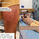 Ex-ator global é hospitalizado na Indonésia após sofrer ataque severo de ácaros